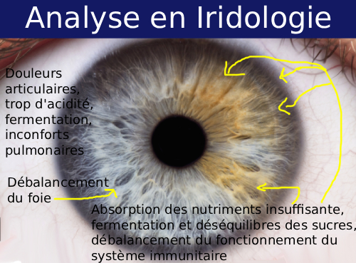 consultation en iridologie